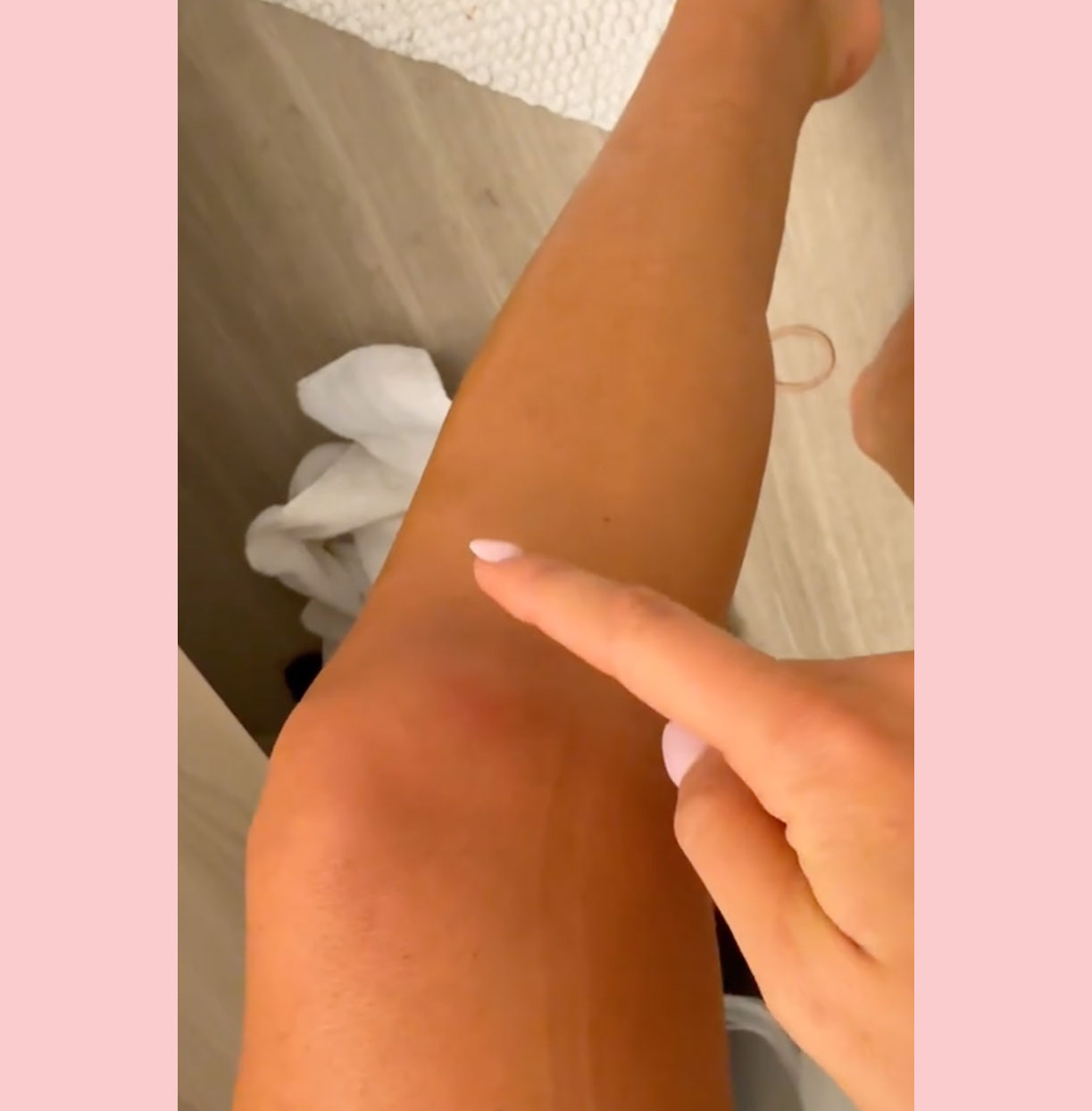 Alix Earle injuries dwts