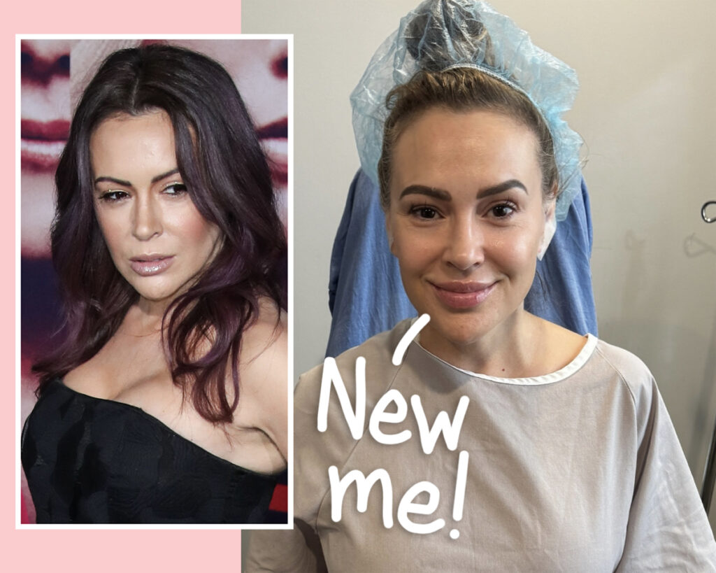 Alyssa Milano Getting Her Breast Implants Removed! She Says...