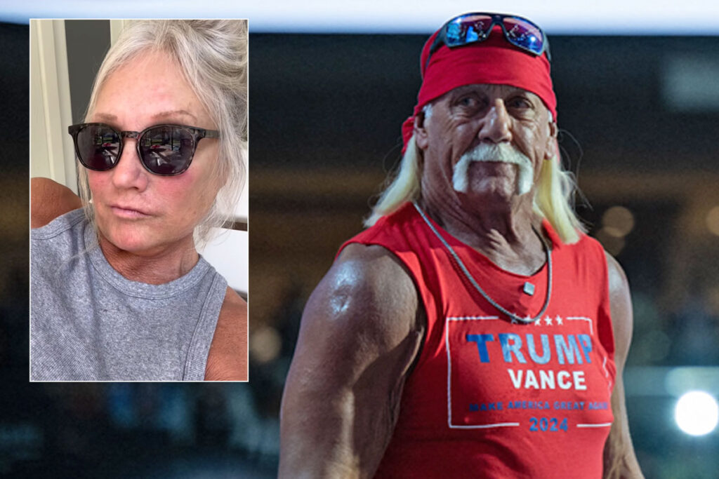 Hulk Hogan's Ex-Wife Linda Blasts Emmys For In Memoriam Snub -- Says She Thinks It Was Political!