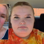 Mama June Reveals Daughter Honey Boo Boo Was Injured In Scary Car Crash!