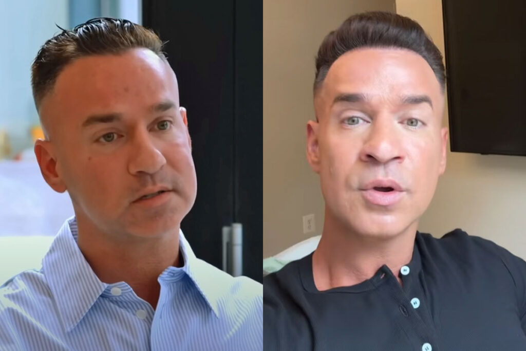 Mike ‘The Situation’ Sorrentino Addresses Facelift Rumors After Completely Shocking Fans With Appearance!