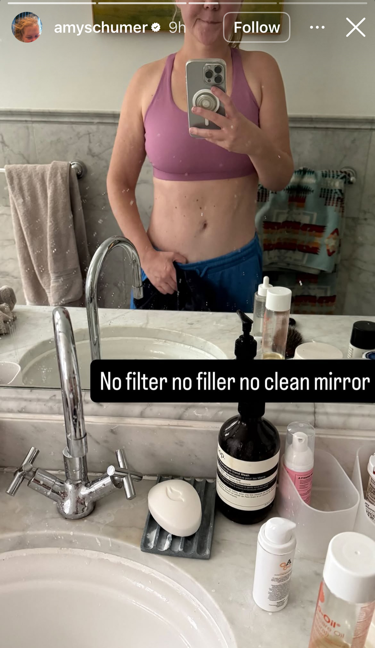 Amy Schumer Strips Down For Mirror Selfie To Give 'No Filter' Look At Impressive Weight Loss!