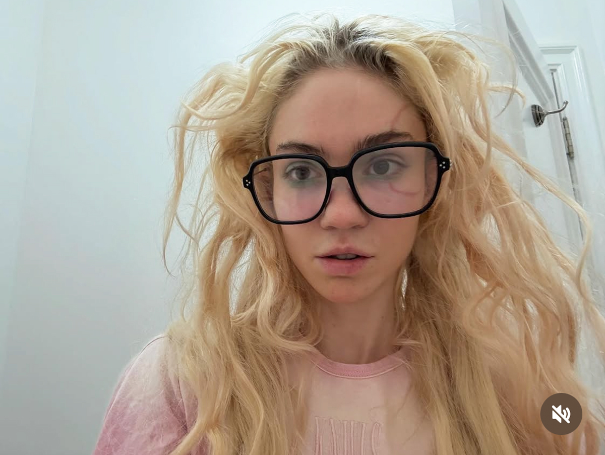 Grimes Got A Face Tattoo! But Her Fans Think It Looks TERRIBLE -- Like An Infection!