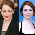 Emma Stone Fans IN SHOCK At Her 'Unrecognizable' New Look -- Plastic Surgeon Thinks She Got...