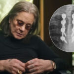 Ozzy Osbourne Documentary Bombshell: He Believed His Back Surgery Was Botched!