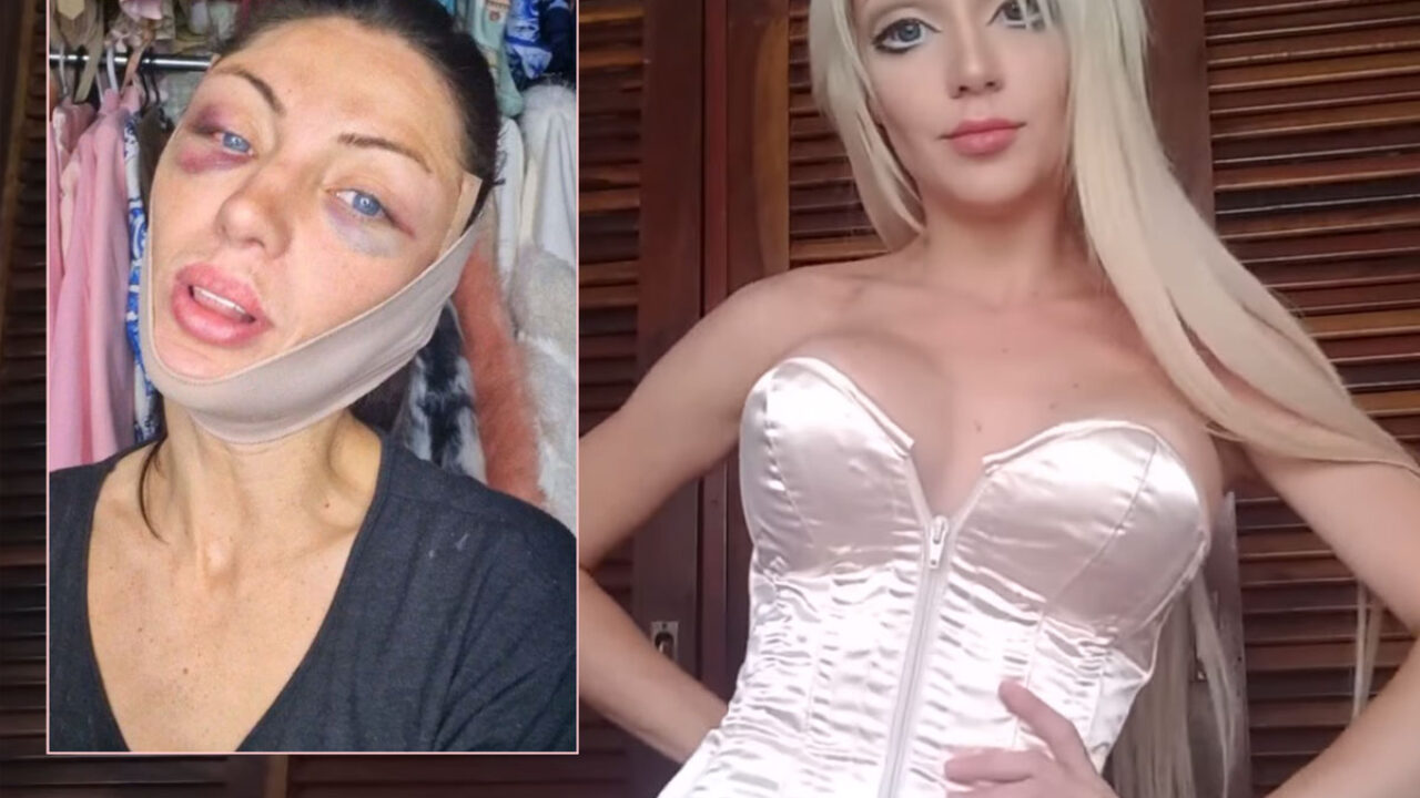 human sex doll plastic surgery Woman who spent £100,000 on being a 'doll' shares image of how she used to  look main image 1