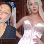 'Human Barbie' Influencer, Known For Extensive Plastic Surgeries, Dead At 31 Under Suspicious Circumstances