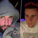 Justin Bieber Injured After GNARLY Fall: 'Hurts So F**king Bad'