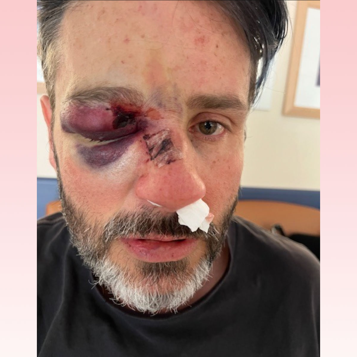 4-year-old Ronan Kerr dead in freak accident