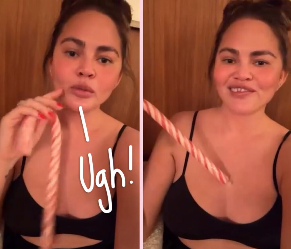 Chrissy Teigen Is Toothless Now -- LOOK!