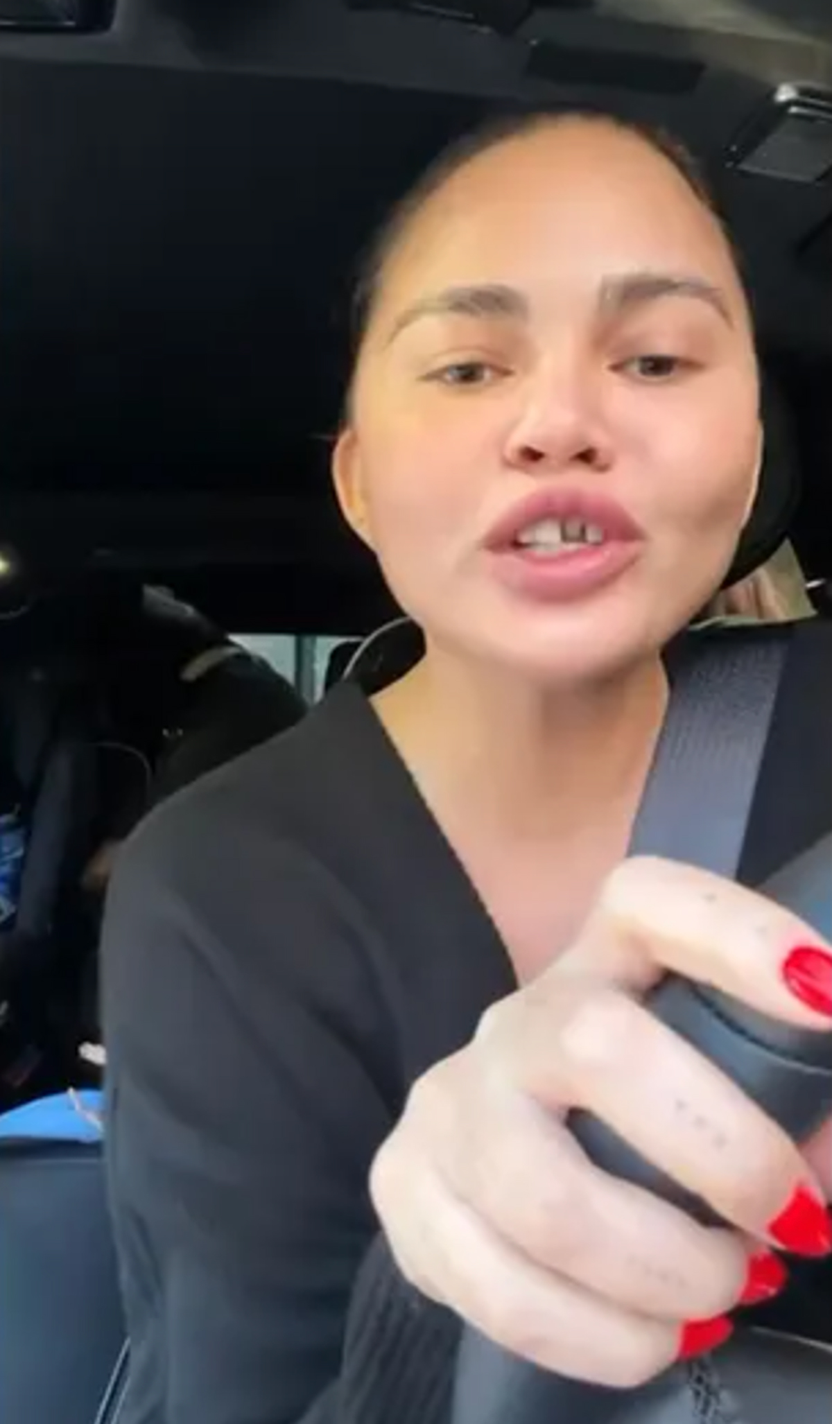 Chrissy Teigen Is Toothless Now -- LOOK! 