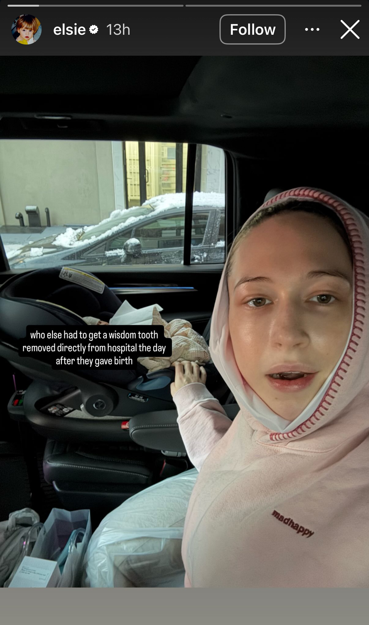 Damn, Girl! Pete Davidson's Girlfriend Elsie Hewitt Had To Get A Tooth Removed DAY AFTER Giving Birth!