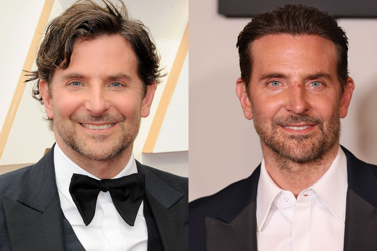 Bradley Cooper addresses plastic surgery speculation