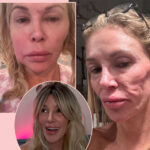 Brandi Glanville Debuts Brand New Look At The Sundance Film Festival Post-Facial Parasite Diagnosis! See The Pic!