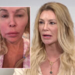 Brandi Glanville Got Her Facial Parasite From Her BREAST IMPLANTS! How It Happened And How YOU Can Avoid It!