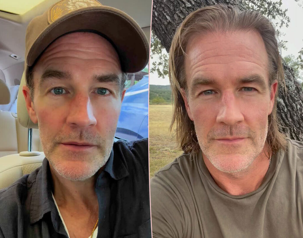 The Cancer Symptom That Compelled James Van Der Beek To Get A Colonoscopy