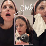Bethenny Frankel Accidentally SLICES Her Face Open With Skin Care Tool In Scary New Video -- WATCH!