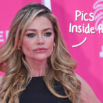 Denise Richards Debuts Transformative Facelift! See The Before-And-After Photos!