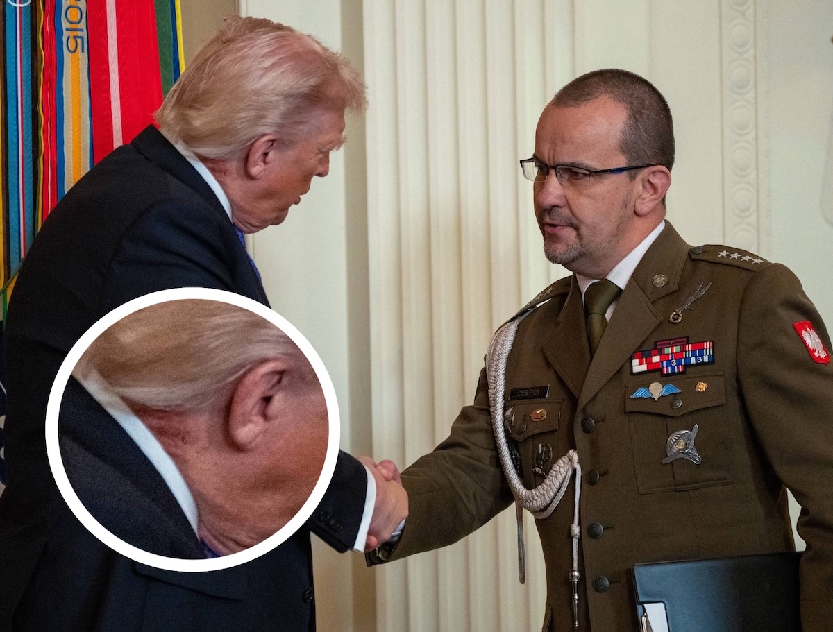 What's That On Donald Trump's Neck? His Doctor Reacts!