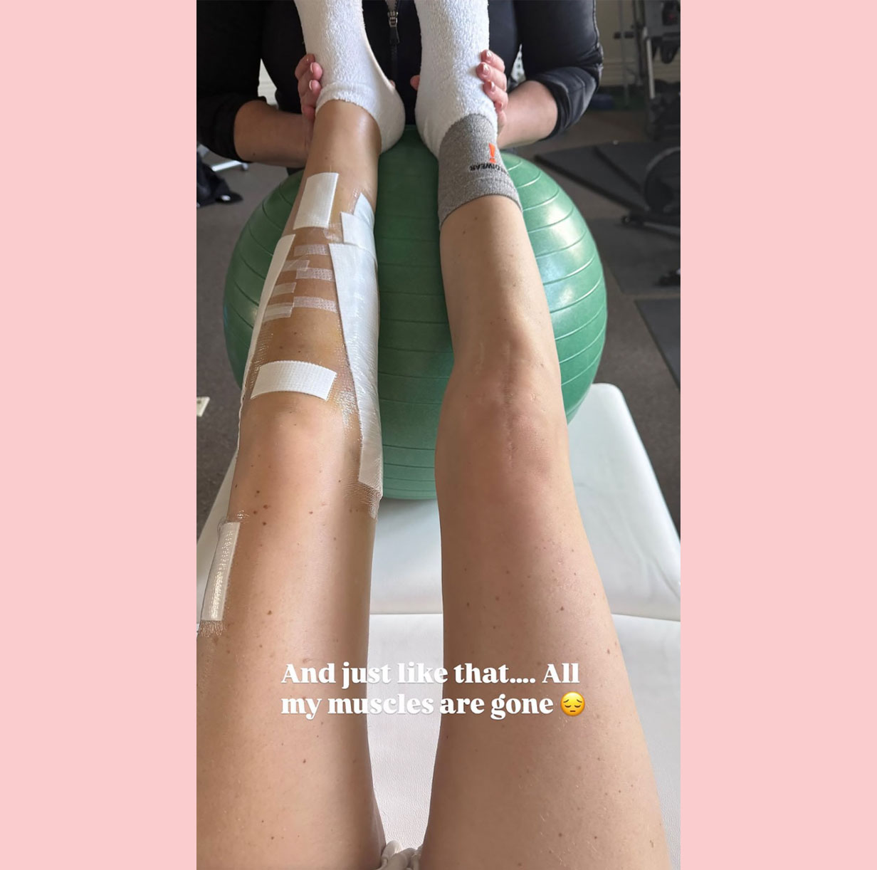 Lindsey Vonn Says All Her Muscles Are Gone And Shares New Pic After Horrifying Crash