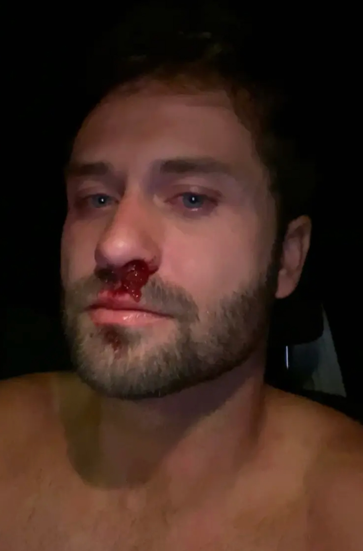 Dakota Mortensen Asked Taylor Frankie Paul If She Wanted To Sleep Together -- After She Revealed Bloody Injury From Violent Fight!