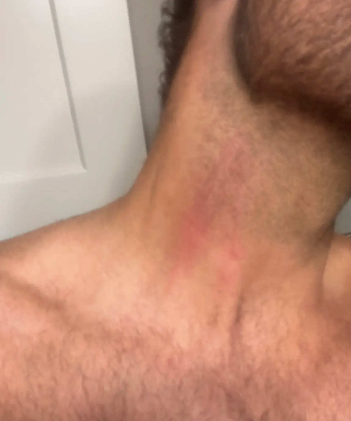 Dakota Mortensen Asked Taylor Frankie Paul If She Wanted To Sleep Together -- After She Revealed Bloody Injury From Violent Fight!