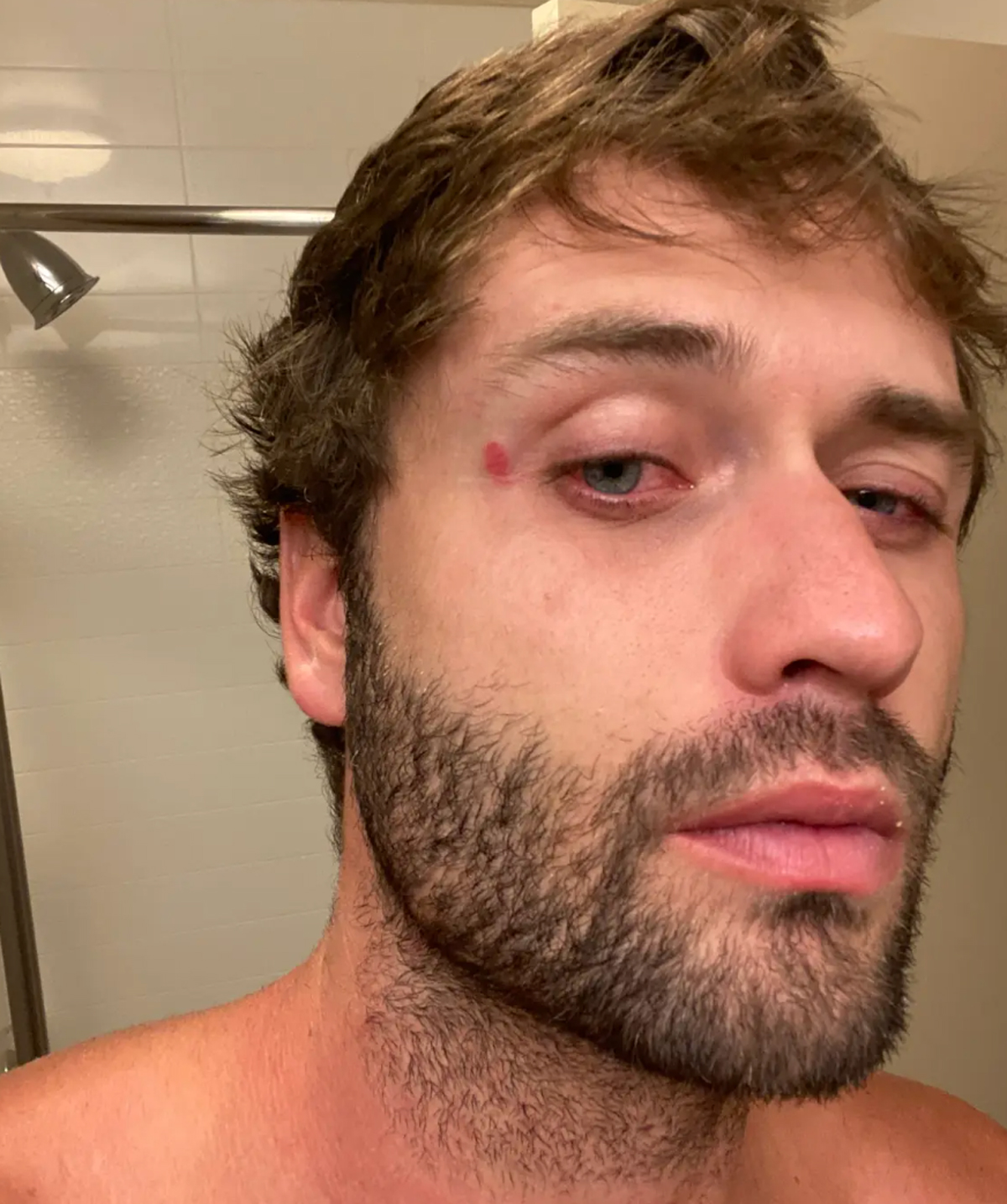 Dakota Mortensen Asked Taylor Frankie Paul If She Wanted To Sleep Together -- After She Revealed Bloody Injury From Violent Fight!