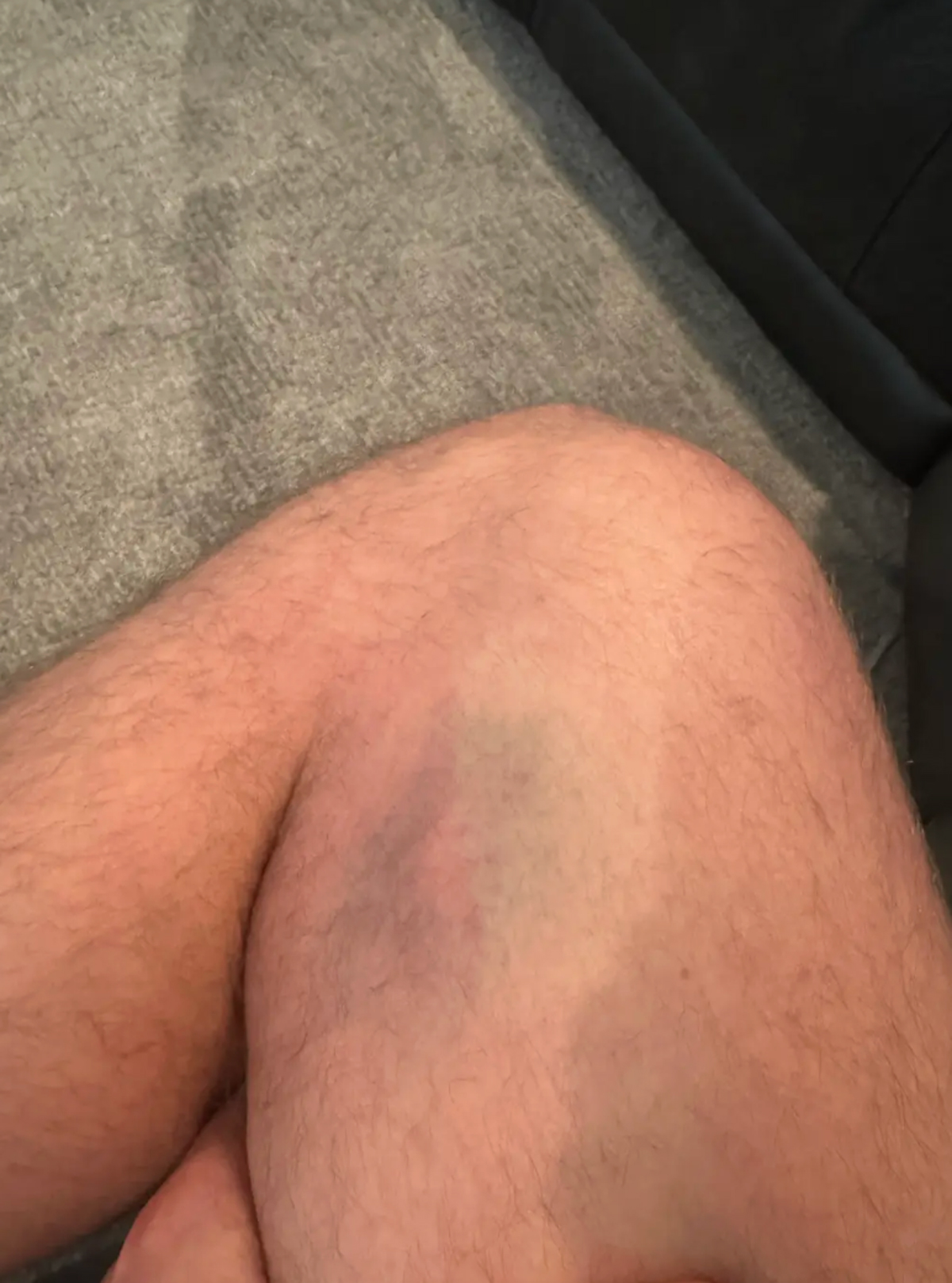 Dakota Mortensen Asked Taylor Frankie Paul If She Wanted To Sleep Together -- After She Revealed Bloody Injury From Violent Fight!