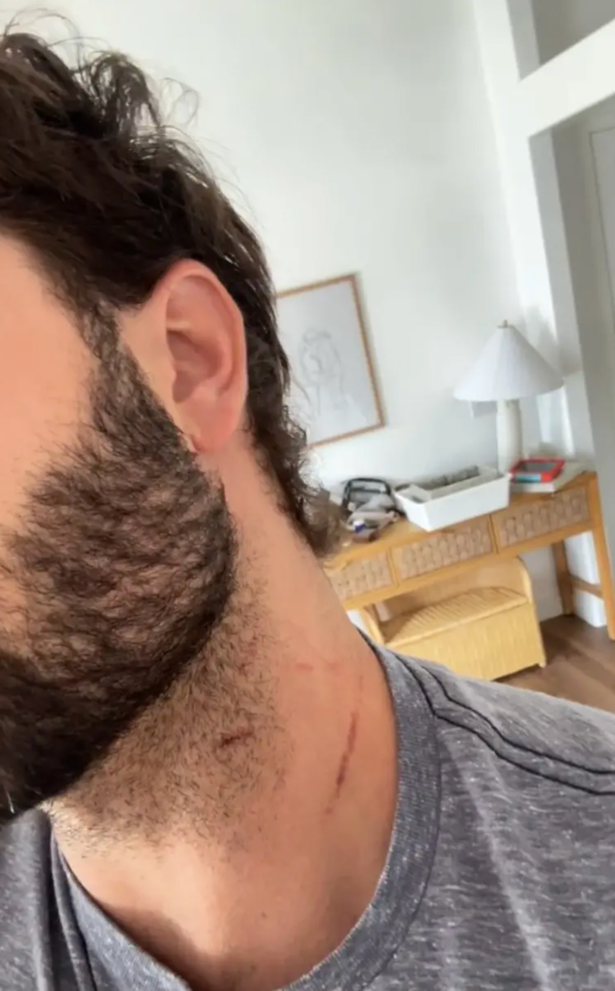 Dakota Mortensen Asked Taylor Frankie Paul If She Wanted To Sleep Together -- After She Revealed Bloody Injury From Violent Fight!