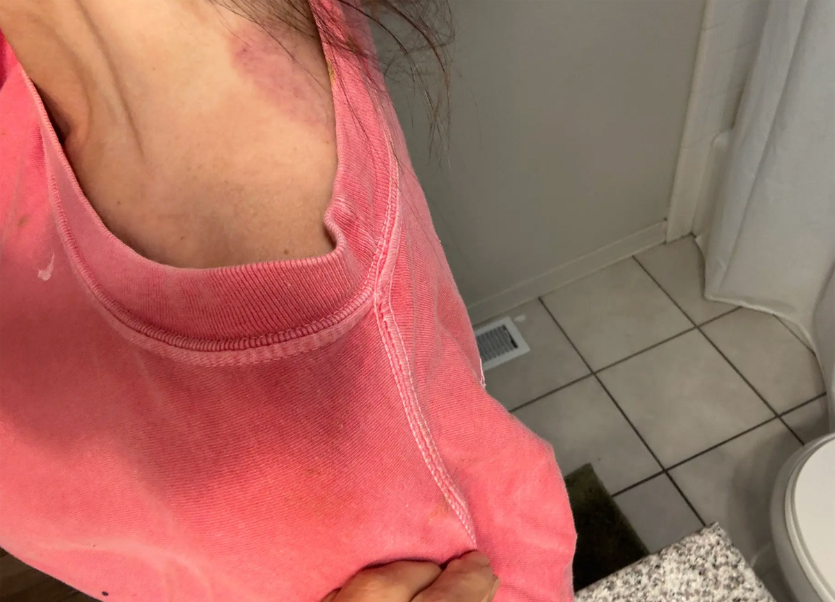 Dakota Mortensen Asked Taylor Frankie Paul If She Wanted To Sleep Together -- After She Revealed Bloody Injury From Violent Fight! 