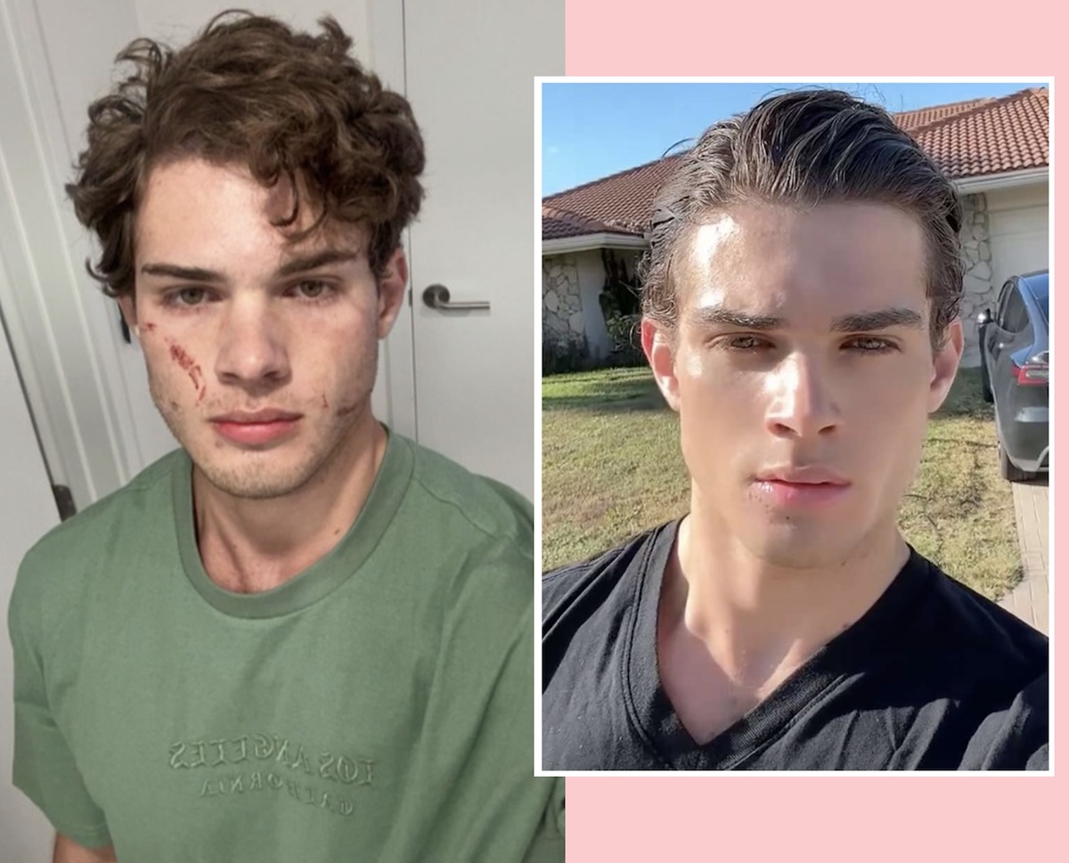 ‘Looksmaxxing’ Influencer Clavicular Recounts Jaw-Dropping Overdose That Led To ‘Brutal’ Hospital Stint
