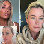 Unfiltered! Teddi Mellencamp Shares Photo Of Brain Surgery Scars As She Asks For Help Amid Cancer Battle