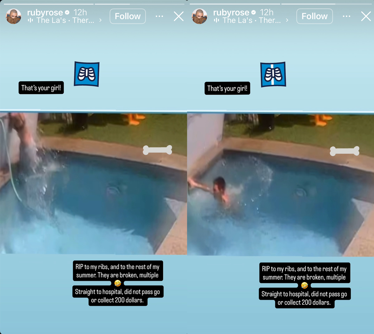 Ruby Rose HOSPITALIZED After Brutal Pool Accident -- Breaks MULTIPLE Bones!
