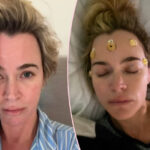 Teddi Mellencamp Tearfully Gets Real About What Cancer Treatment Recovery REALLY Looks Like