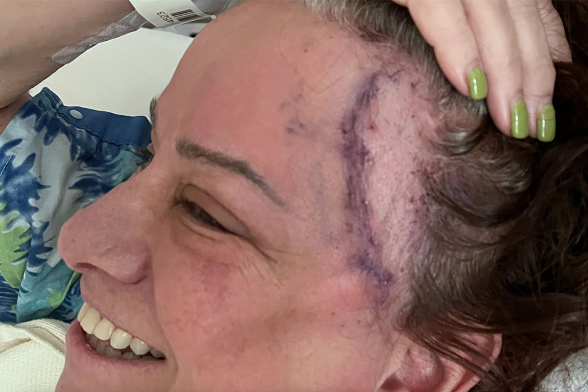 L7 Rocker Jennifer Finch Reveals ‘Aggressive’ Cancer Diagnosis, Shares Photo Of Shocking Brain Surgery Scar