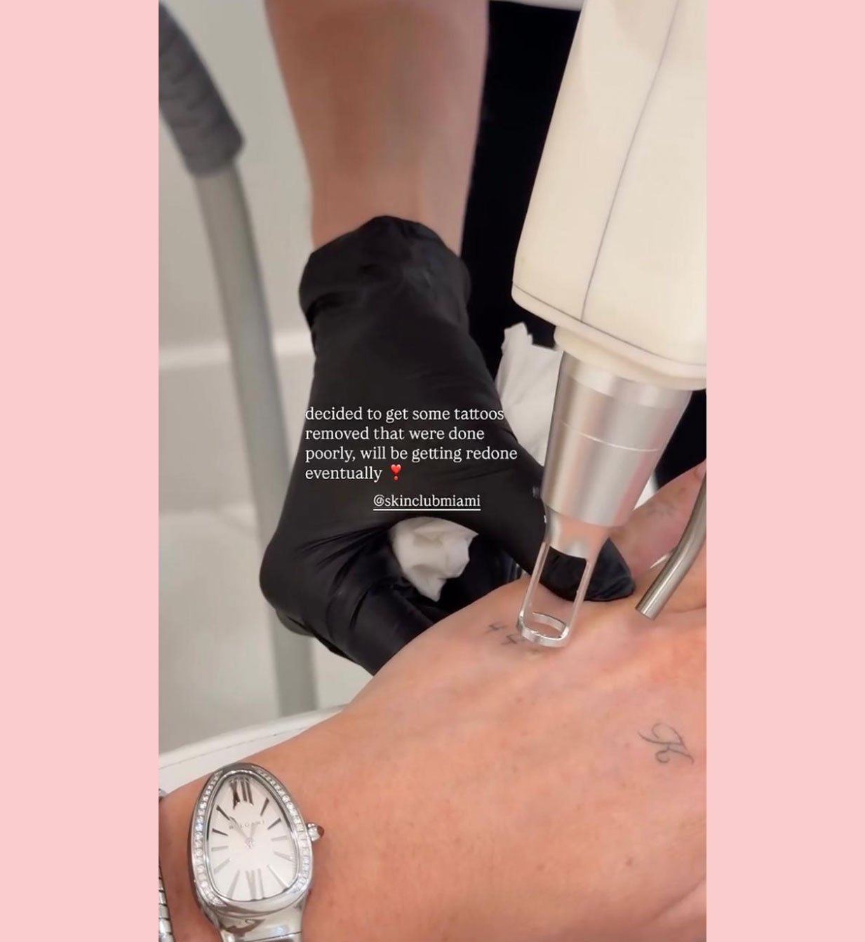 Kate Cassidy tattoo removal instagram stories
